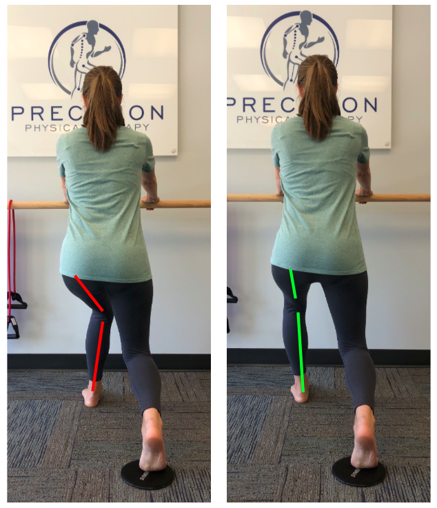 Pure Barre Knee Valgus Posture — Precision Physical Therapy