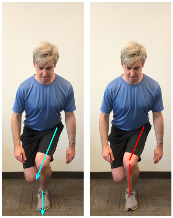 Running Dynamic Knee Valgus — Precision Physical Therapy