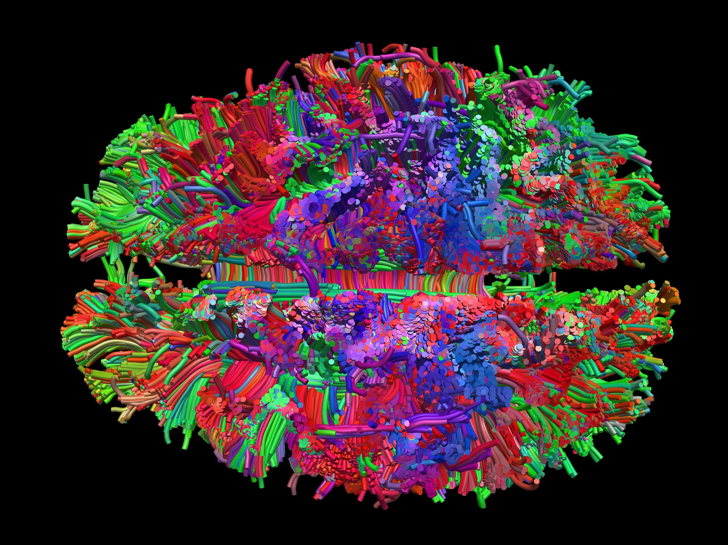 Your Brain on Poetry: Annotated Bibliography 