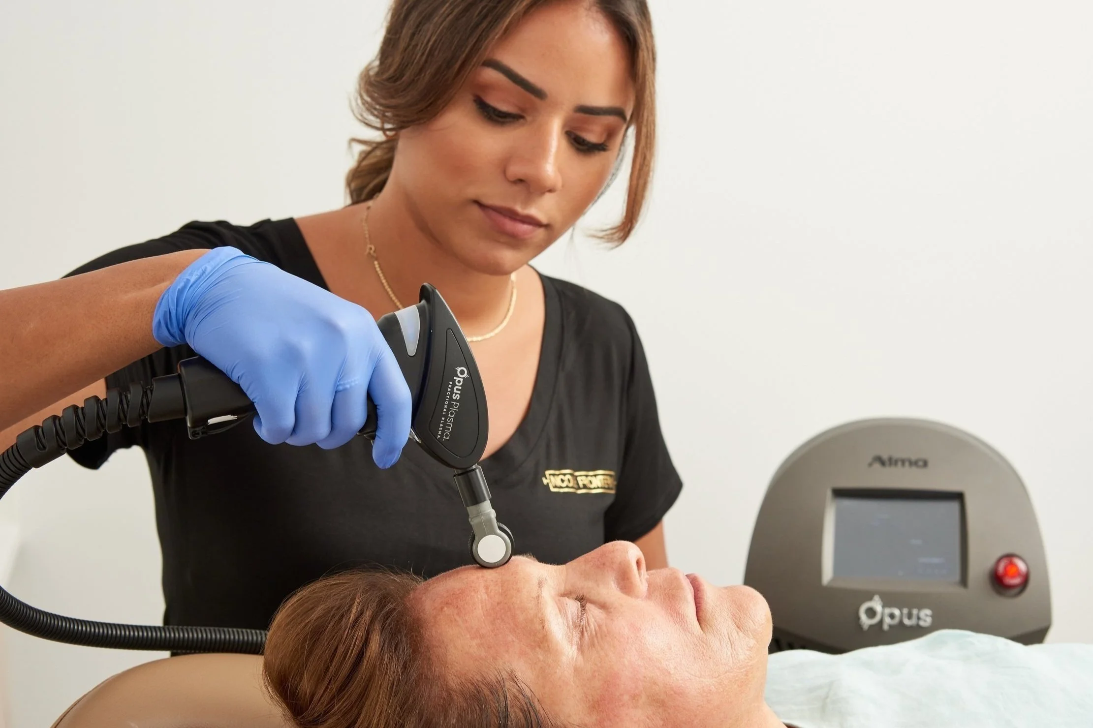 Opus Plasma Laser — Nicole Frontera Beauty