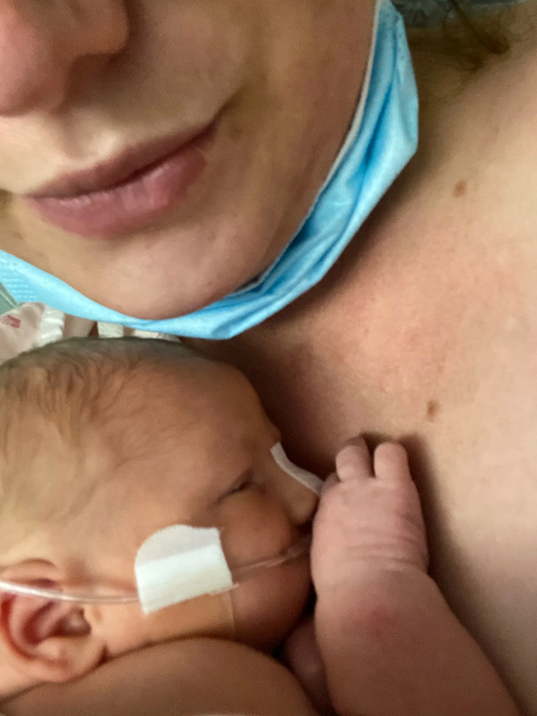 On trauma and therapy