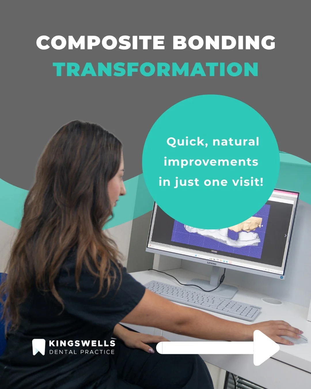 ✨ Transform your smile in just one visit!
Composite bonding offers a quick, natural-looking way to improve the shape, colour, or symmetry of your teeth with beautiful, confidence-boosting results.

At Kingswells Dental Practice, every treatment is ta