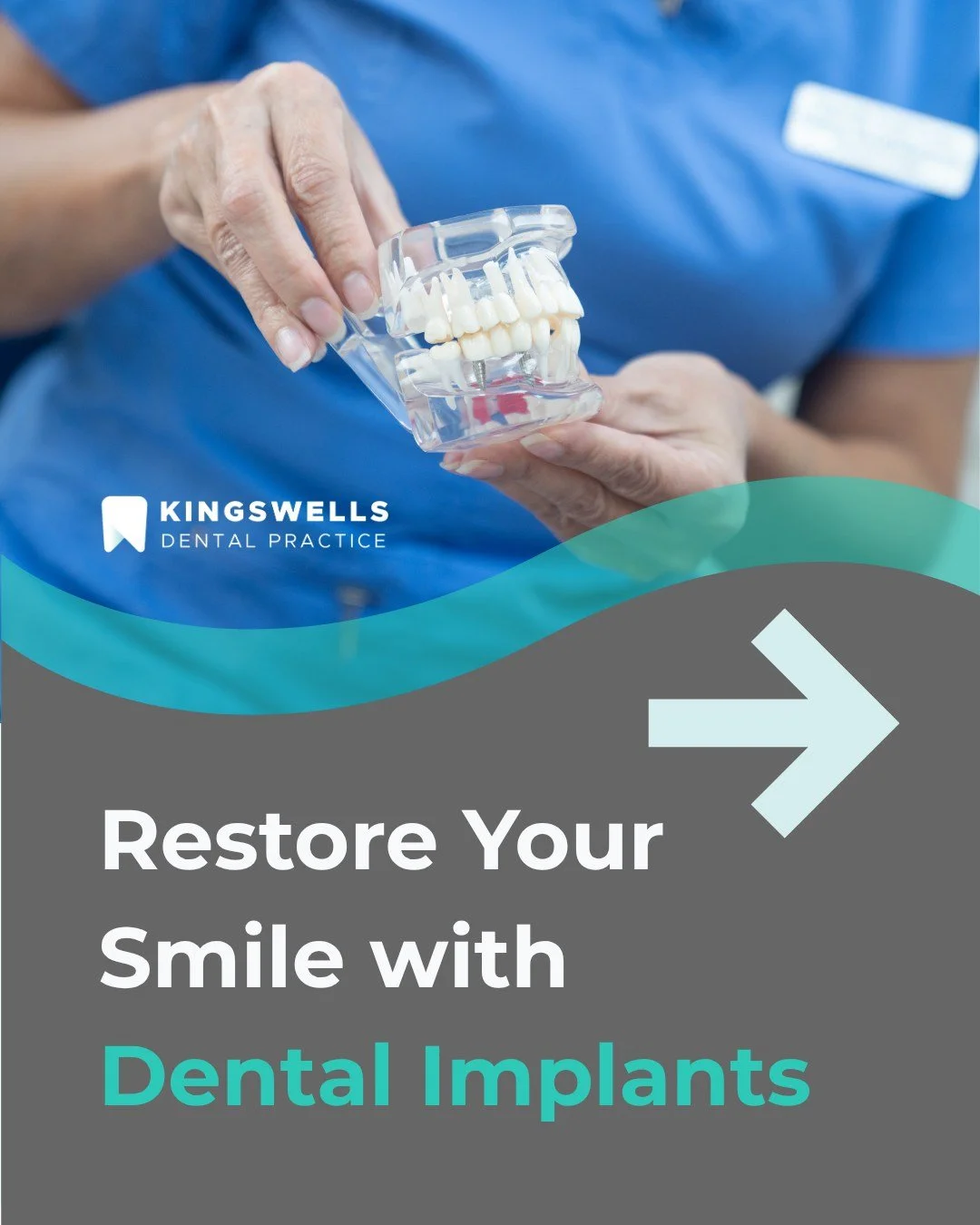 Restore your smile with confidence.
Missing a tooth can change the way you eat, speak and smile, but it doesn&rsquo;t have to stay that way.

At Kingswells Dental Practice, we offer dental implants: a secure, natural-looking solution designed to last