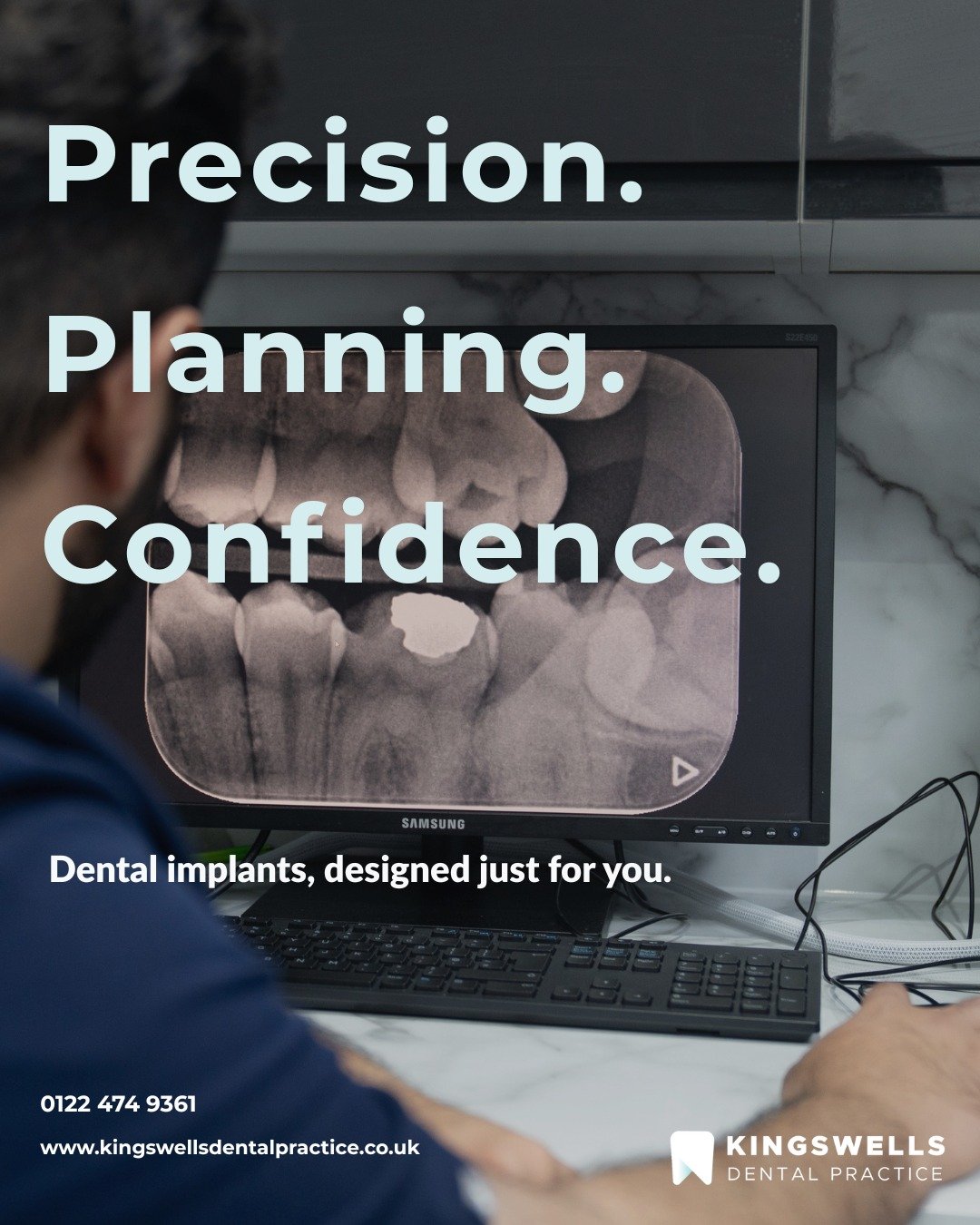 Every confident smile starts with careful planning. 💙
At Kingswells Dental Practice, our team uses detailed X-rays and digital scans to create precise, long-lasting dental implant solutions. Designed just for you.
✨ Natural look &amp; feel
🦷 Long-l