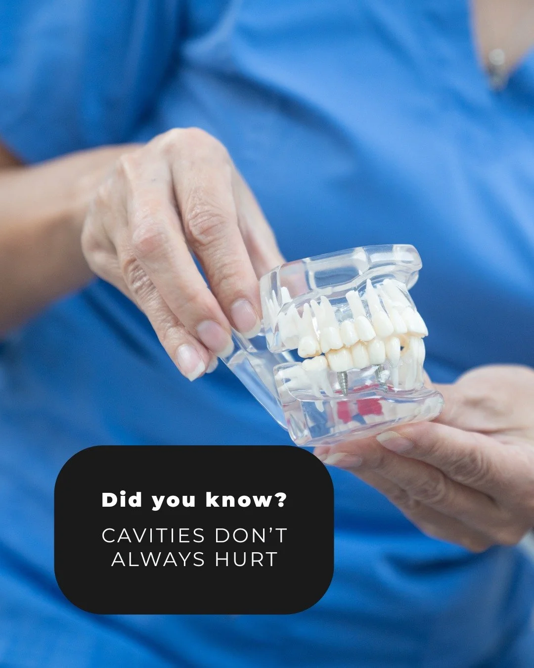 Did you know cavities don&rsquo;t always hurt? 👀🦷

That&rsquo;s why regular dental check-ups are so important, many issues can develop without any symptoms at all.

Dr. Leen explains why catching problems early can save time, discomfort, and more c