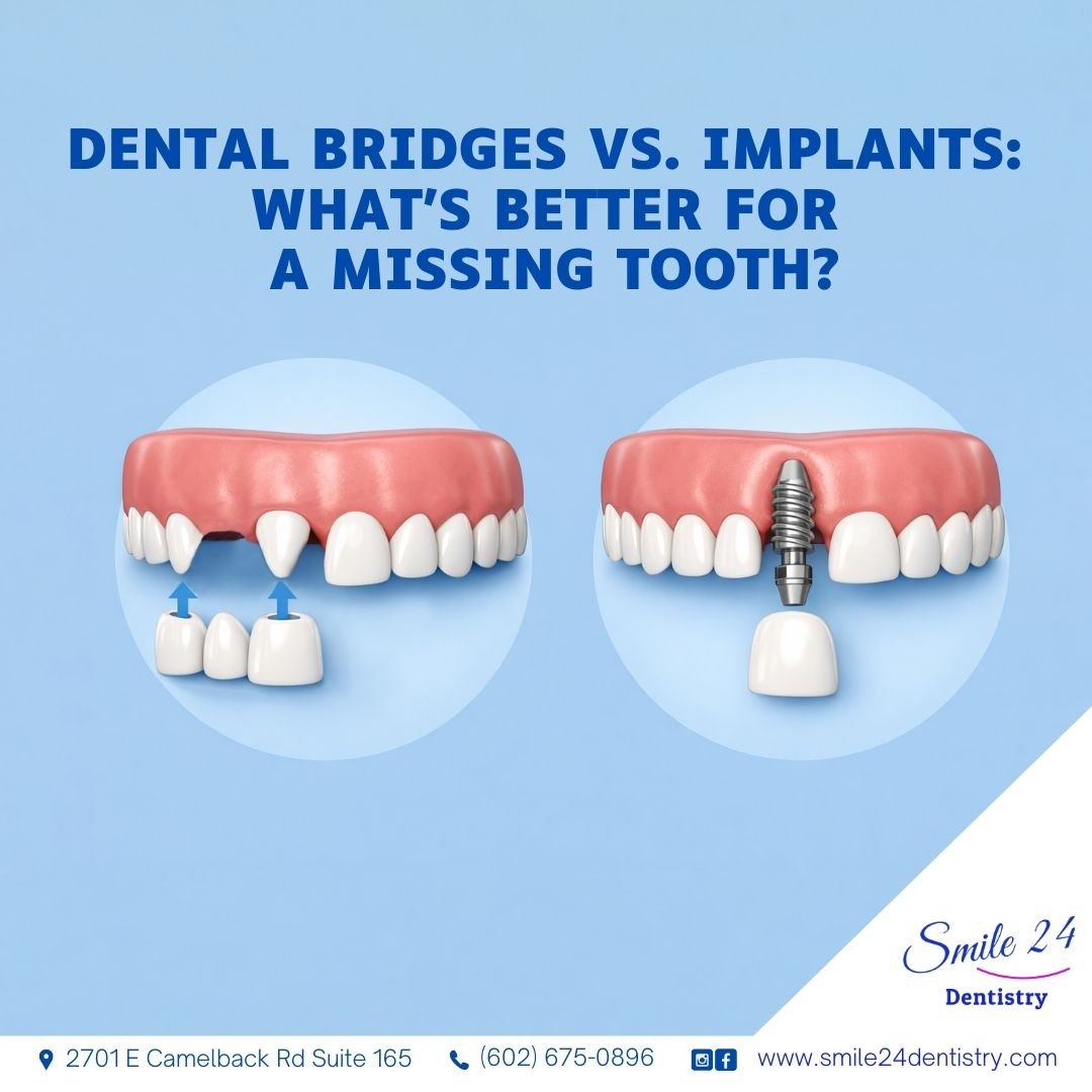 what is better for a missing tooth? dental bridge or implant . Phoenix dental care
