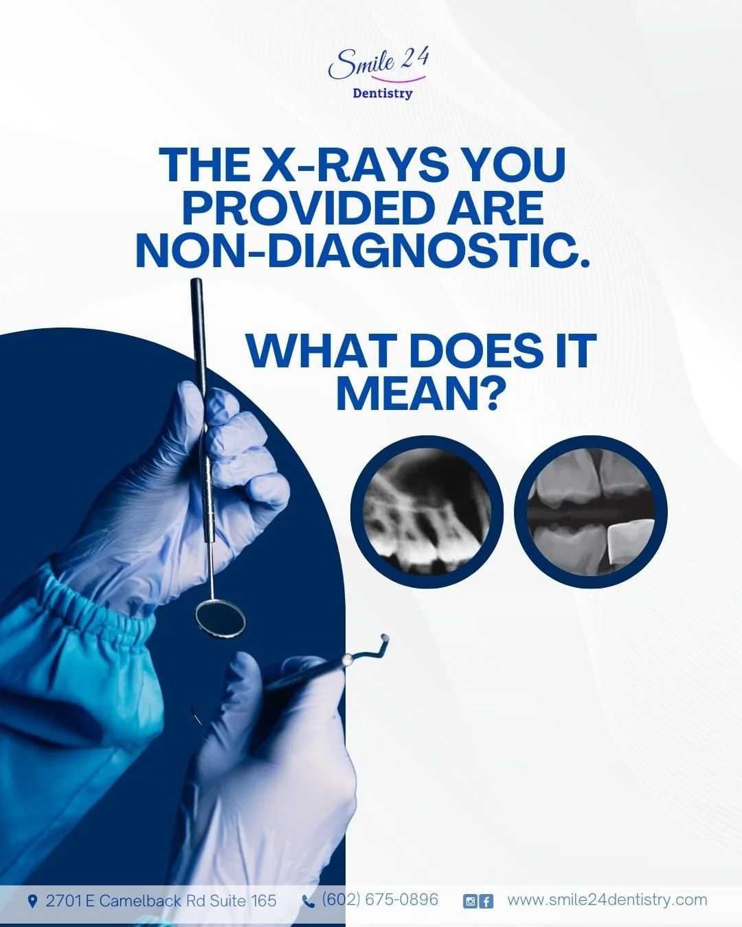 Why X-Rays from Another Dental Office May Need to Be Repeated. Smile 24 Dentistry – Phoenix, AZ (Biltmore Area)