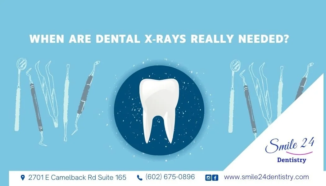 When Are Dental X‑Rays Really Needed? Understanding Safe, Smart Imaging for Your Smile