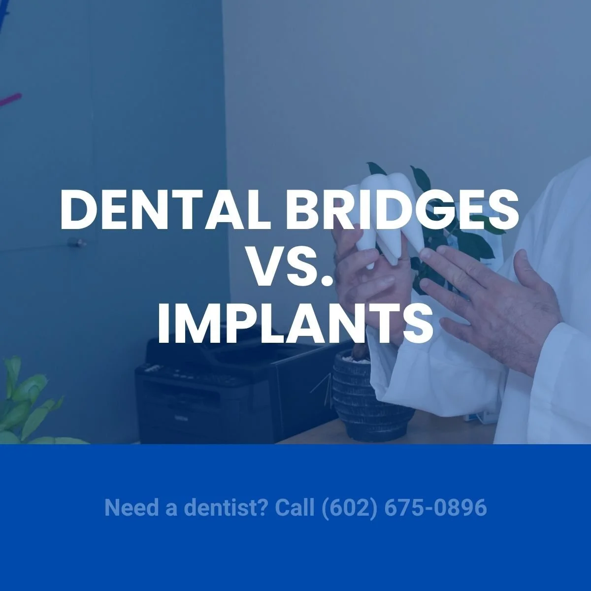 Dental bridges vs. implants: what’s better for a missing tooth?