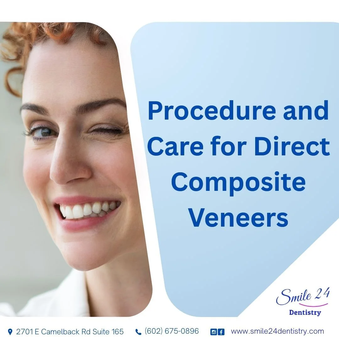 Care for Direct Composite Veneers