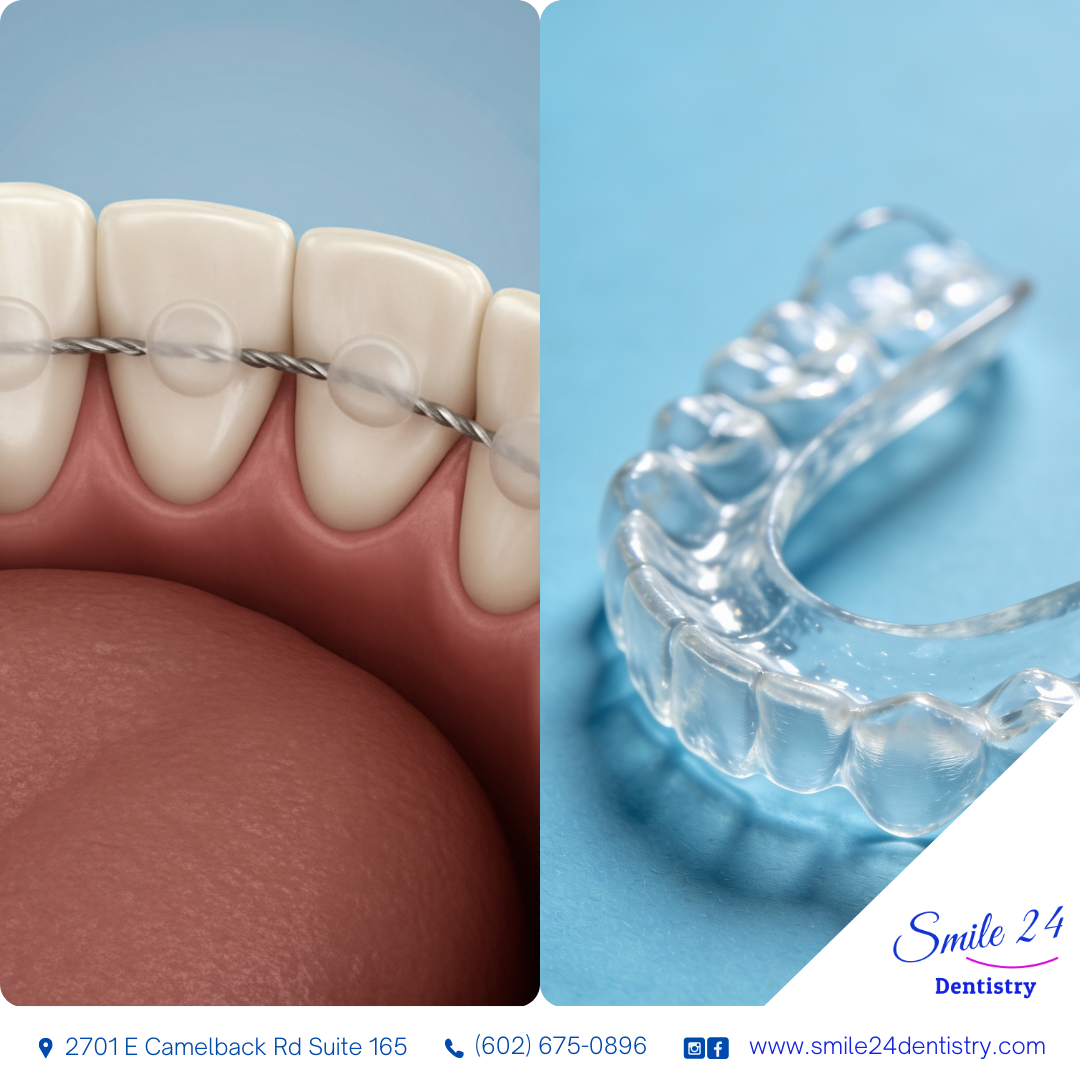 Why you need to wear a retainer