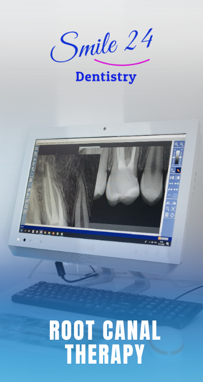 Root Canal Therapy in Phoenix, Scottsdale