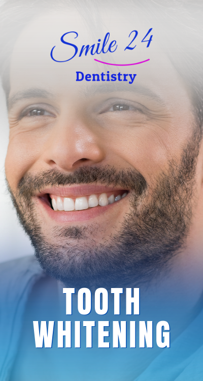 Professional Tooth Whitening in Phoenix, Scottsdale Arizona