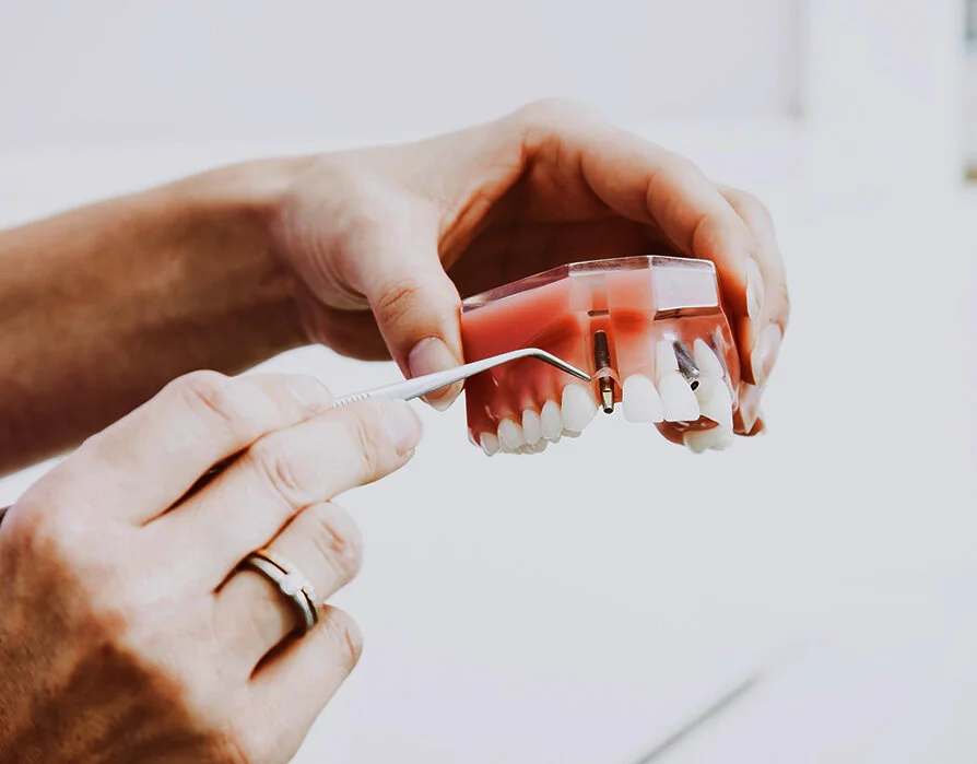 Implant Dentistry.jpg