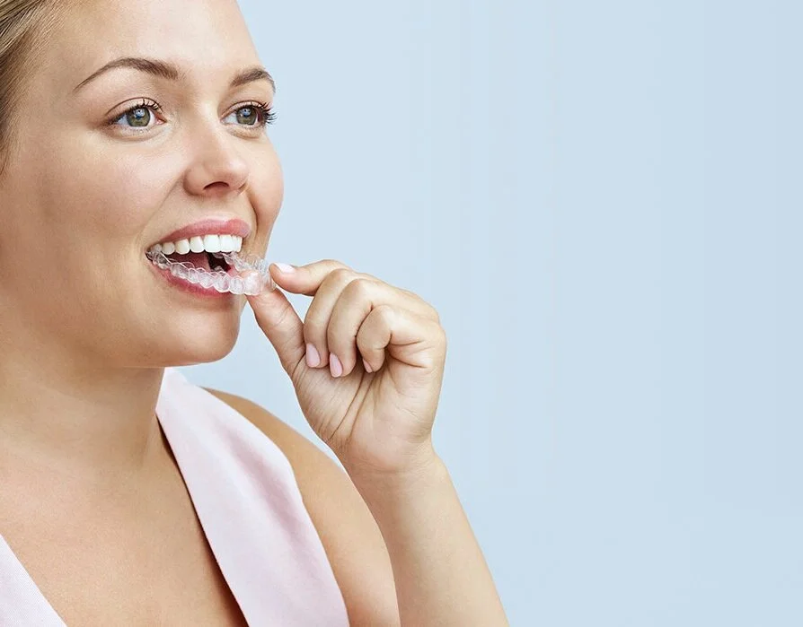 Invisalign.jpg