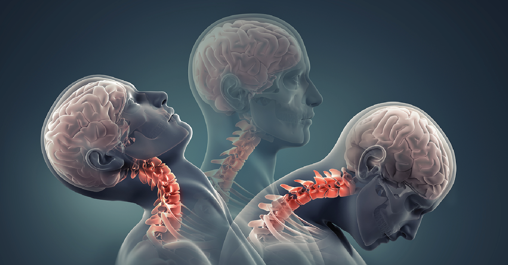 In Person: Dural Tissue Therapy (DTT) Part 1