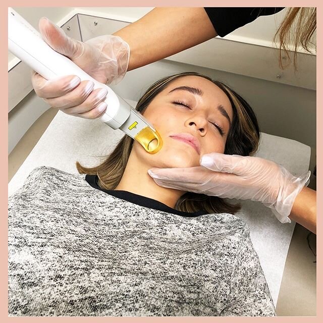 Time to get rid of that unwanted facial hair, with Medlife Aesthetics. Give us a call today to learn how. .
.
.
.
.
.
.
.
#flawlesslasercenter #hairfreecarefree #laserhairremoval #medicalspa #medspa #beautifulyou #hairfreecarefree #flawlesslaser #fla