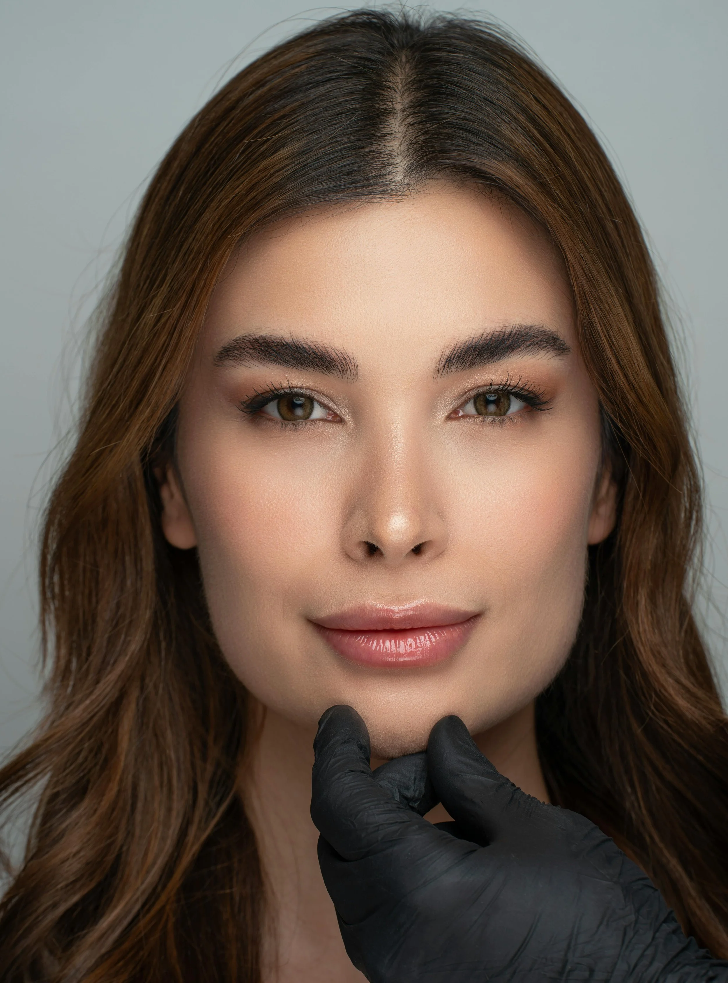 Marionette Lines and Mid-Face Aging: Restore a Youthful Look