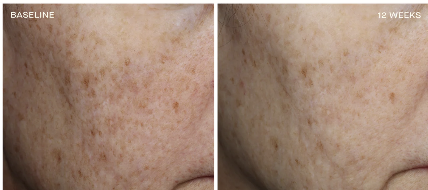 Screenshot 2025-11-17 at 6.51.13 AM.png