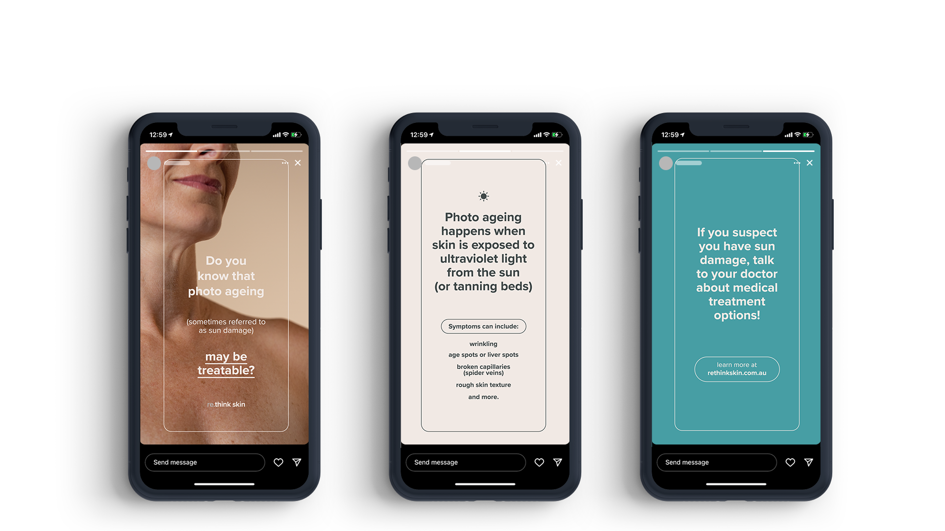 Retrieve Stories.png