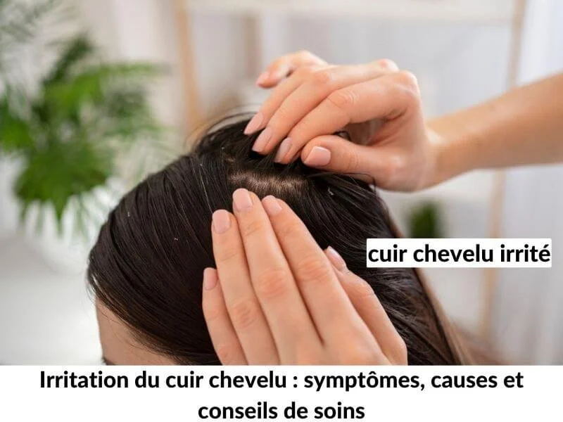 Irritation du cuir chevelu : symptômes, causes et conseils de soins