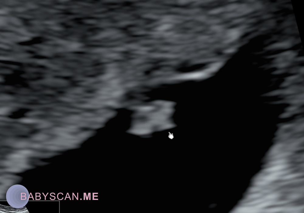 Scans — babyscan.me