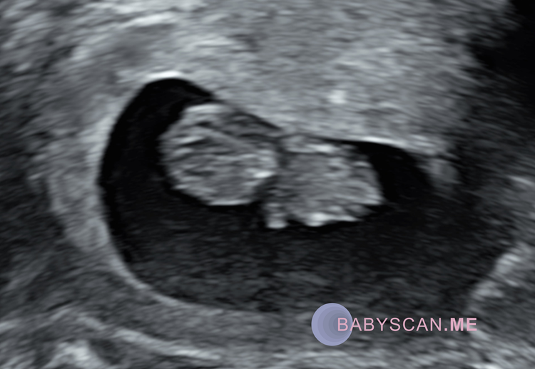 Scans — babyscan.me