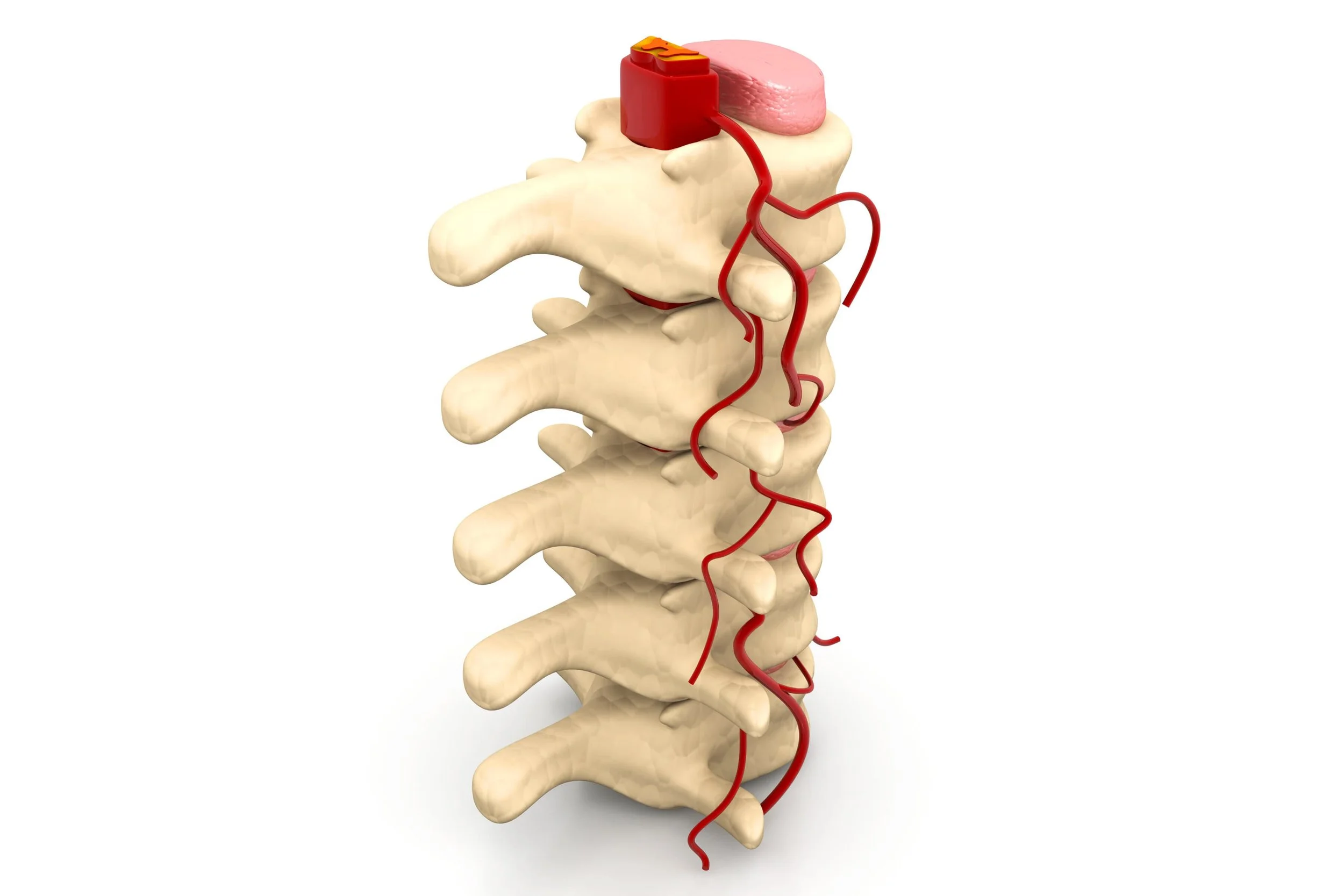 Spinal Cord Stimulation