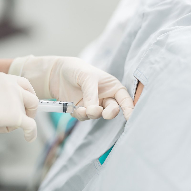 Nerve Blocks