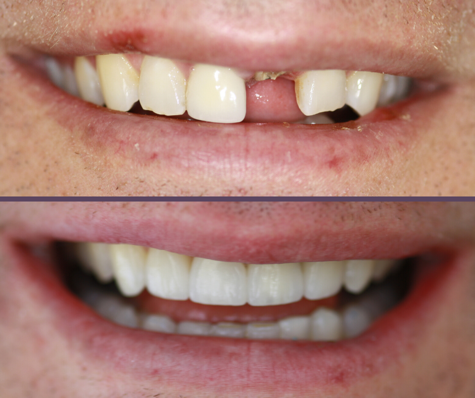 Cosmetic Dentistry