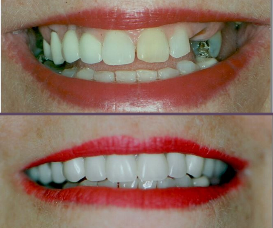 Cosmetic Dentistry