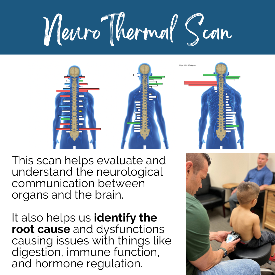 CLA Insight Scans — Summit Life Chiropractic
