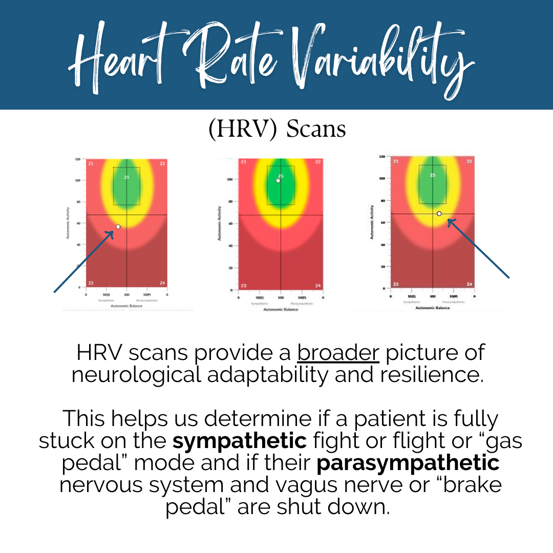 Inly Scan CLA Insight Scans — Summit Life Chiropractic