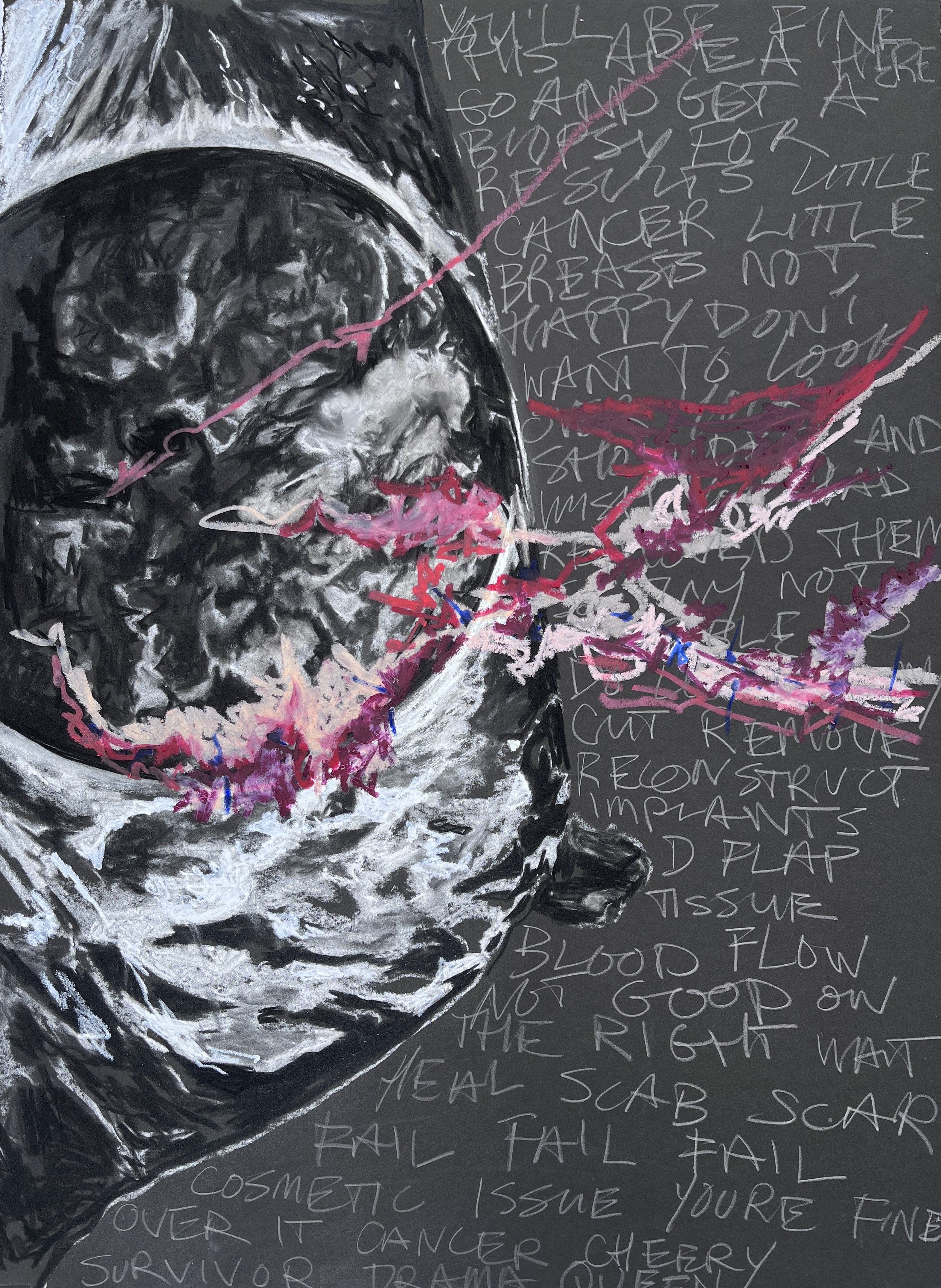 Mammography Journal-You'll Be Fine