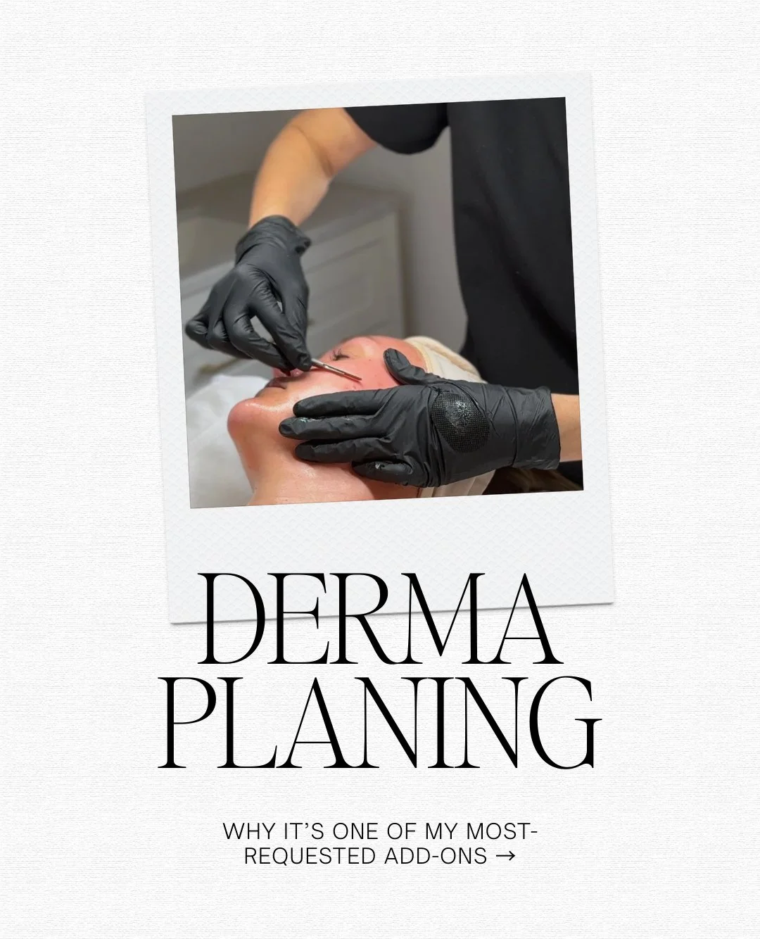 There&rsquo;s just something about dermaplaning that feels like hitting reset ✨⁠
⁠
Smoother skin.⁠
Better product absorption.⁠
Makeup that suddenly glides on like a dream.⁠
⁠
I see clients fall in love with dermaplaning all the time here &hellip; bec