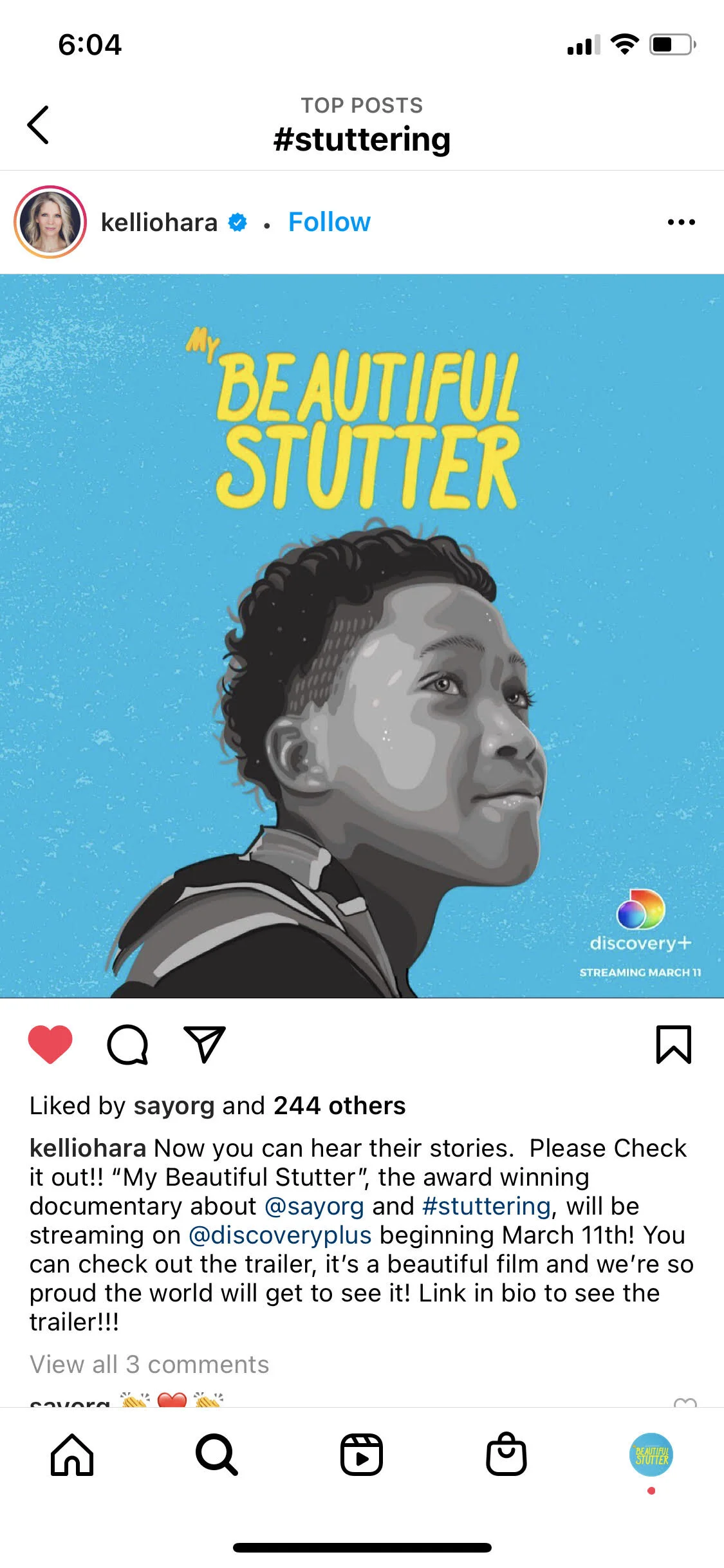 Media My Beautiful Stutter