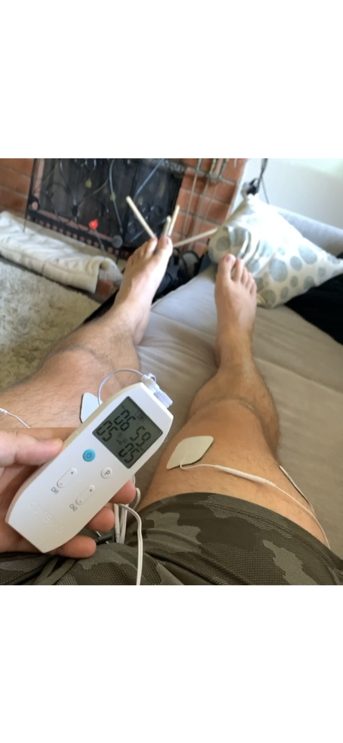 Treatment Spotlight: E-STIM 