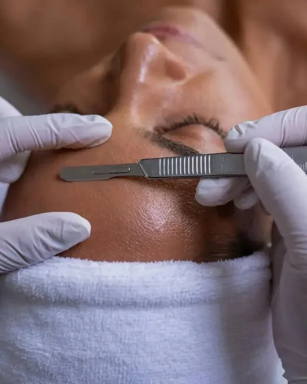 What is Dermaplaning regret?