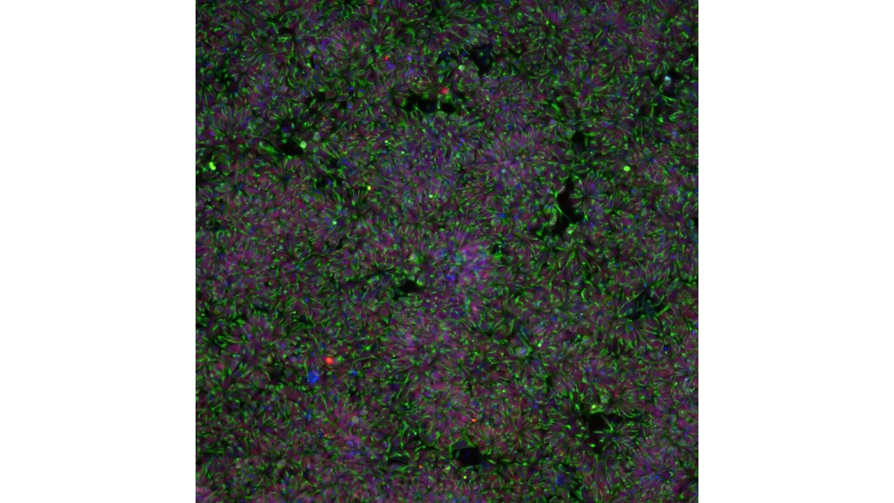 iPSC cortical neurons and gene editing.jpg