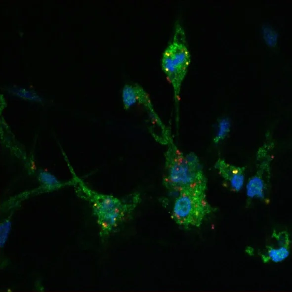 iPSC microglia & Alzheimer's.jpg