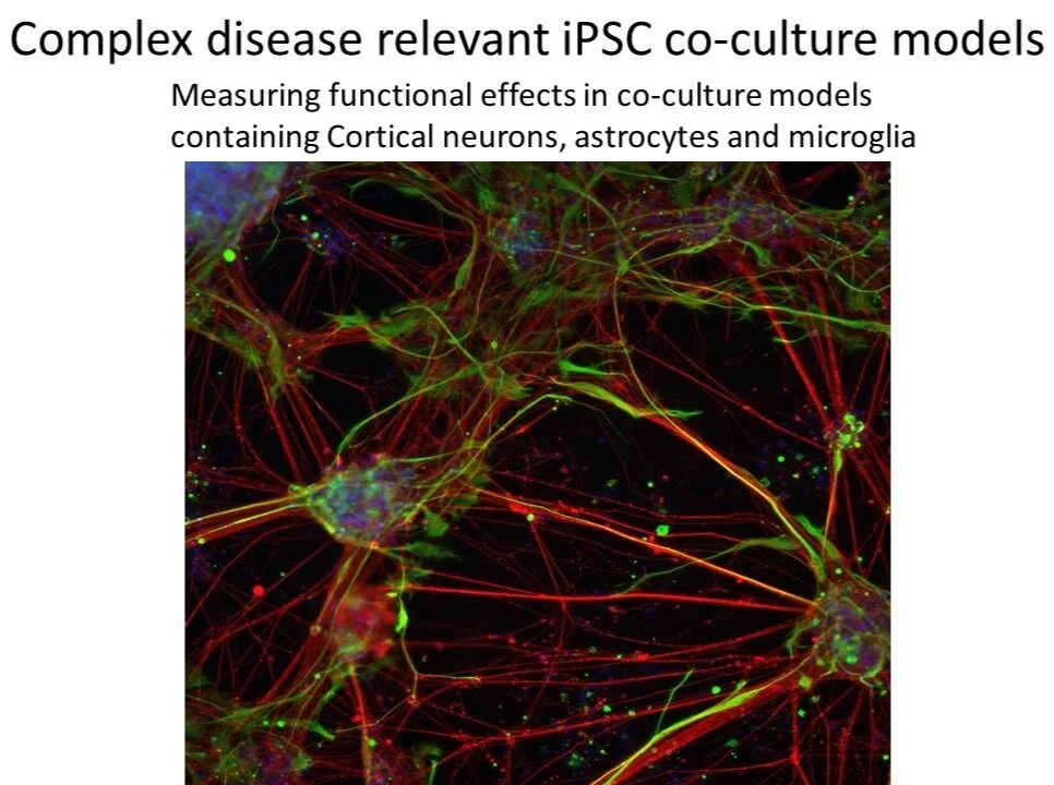 cortical+%26+microglia+%26+astrocyte+co-culture.jpg