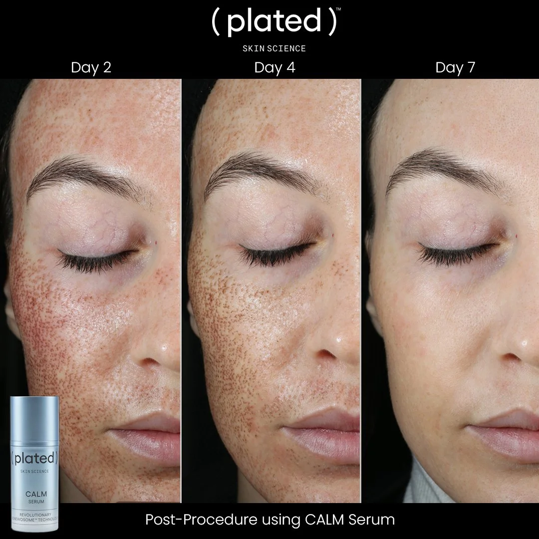 CALM Serum_Before + After (1).jpg