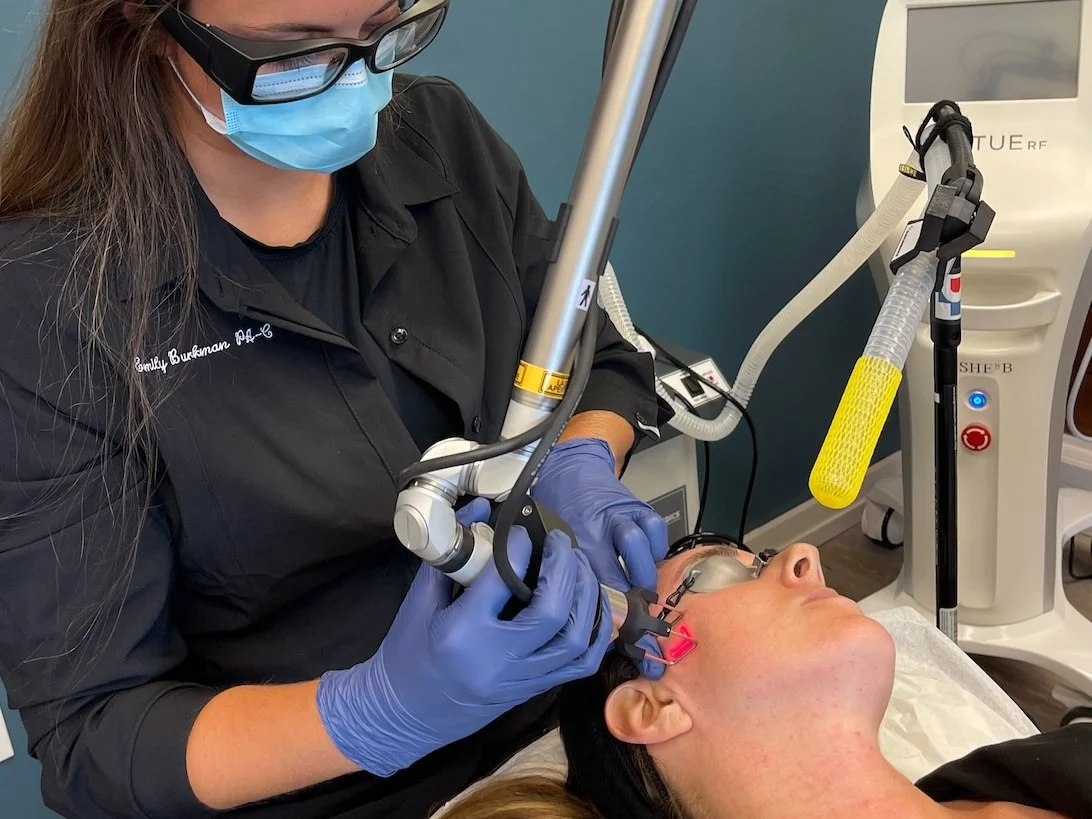 Tetra CO2 Laser — Koru Medical Spa