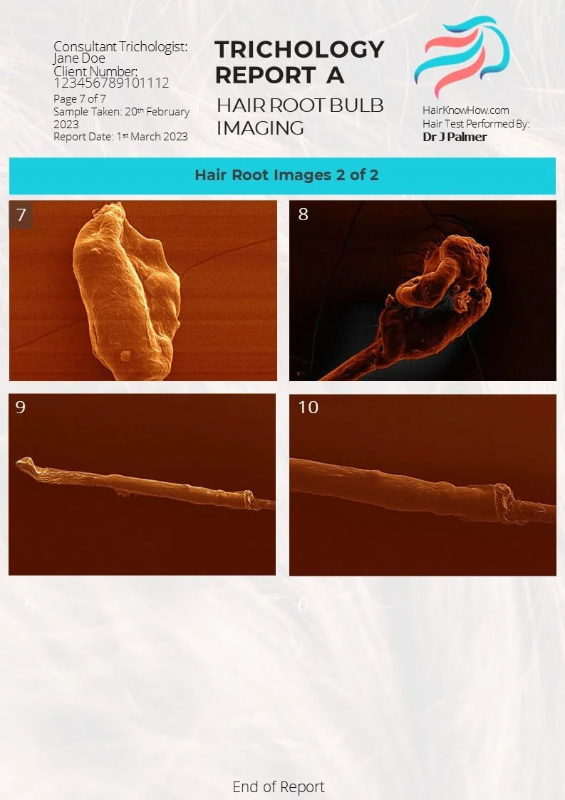 Trichology Analysis Package Hair Root Images