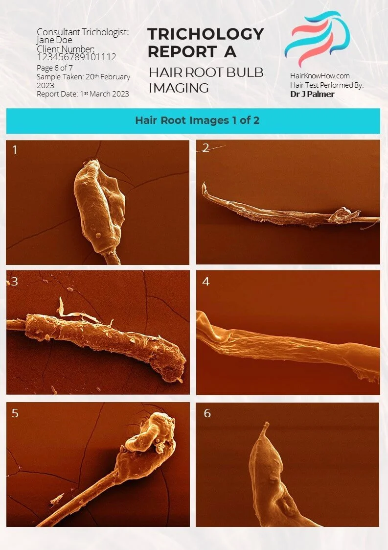 Trichology Analysis Package Hair Root Images