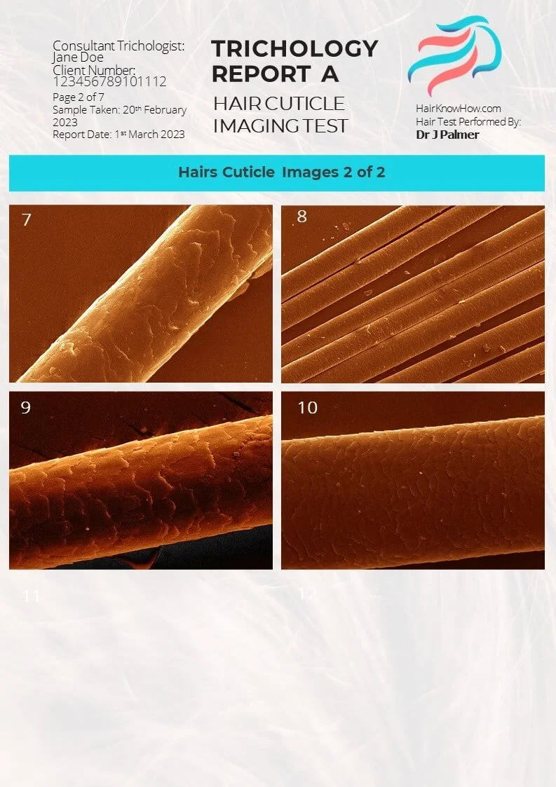 Trichology Analysis Package Cuticle Test
