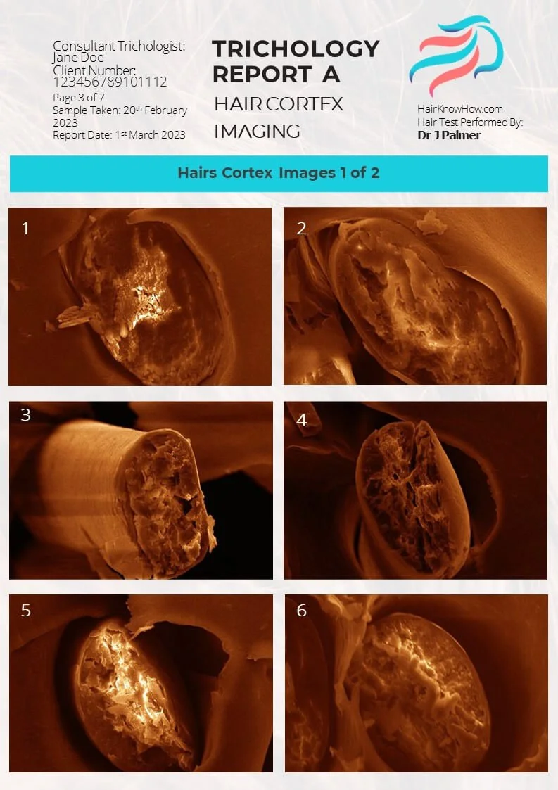 Trichology Analysis Package Cortex Image Test