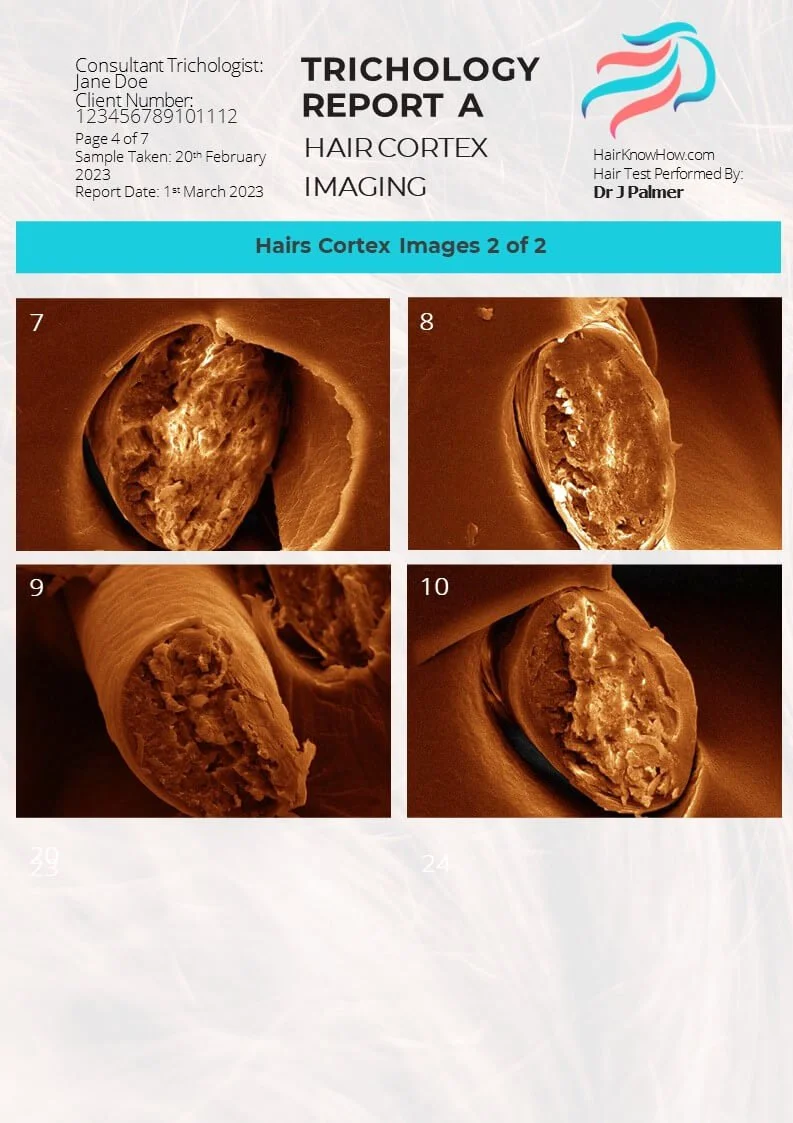 Trichology Analysis Package Cortex Image Test