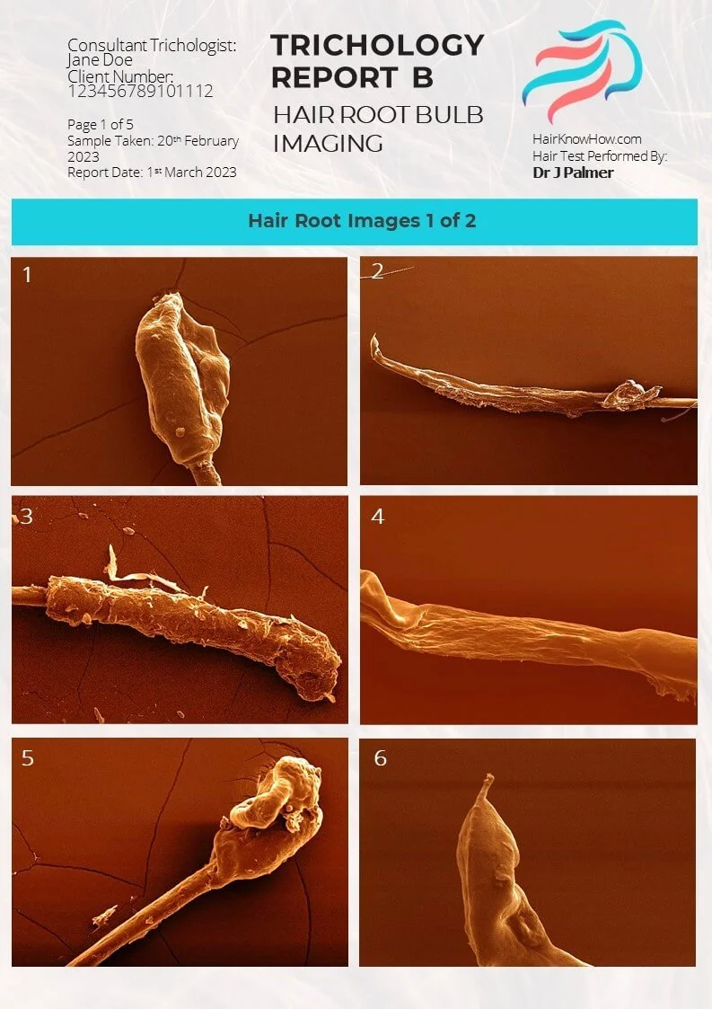 Trichology Analysis Package Hair Root Images