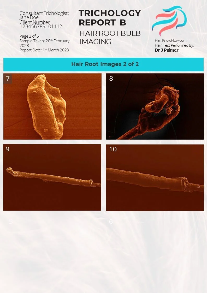Trichology Analysis Package Hair Root Images
